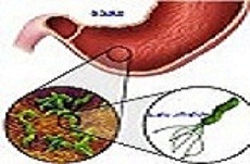 میکروب معده 